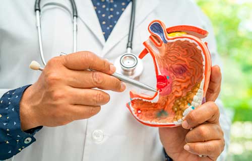 toma de biopsias en Lima con un gastroenterologo